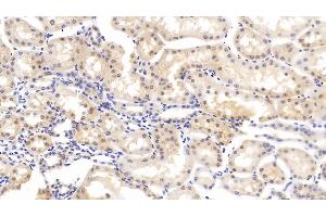 Detection of CASP6 in Bovine Kidney Tissue using Polyclonal Antibody to Caspase 6 (CASP6) (Caspase 6 抗体  (AA 81-179))