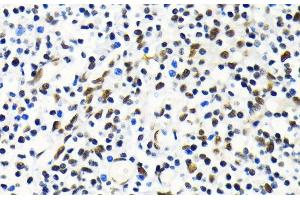 Immunohistochemistry of paraffin-embedded Human tonsil using MKL1 Polyclonal Antibody at dilution of 1:100 (40x lens). (MKL1 抗体)