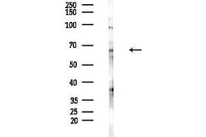 anti-DCP1 Decapping Enzyme Homolog B (DCP1B) (C-Term) antibody