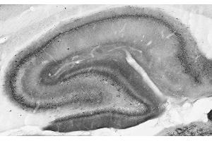 Adult rat hippocampus immunohistochemistry.