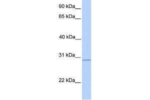 WB Suggested Anti-GALNT10 Antibody Titration:  0. (GALNT10 抗体  (N-Term))