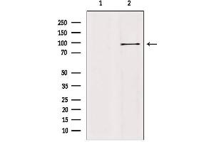 Western blot analysis of extracts from mouse brain, using AAK1 Antibody. (AAK1 抗体  (Internal Region))