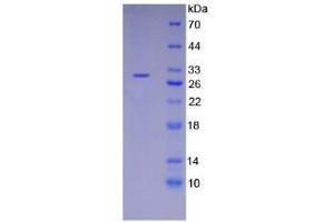 SDS-PAGE analysis of Mouse RIPK3 Protein.