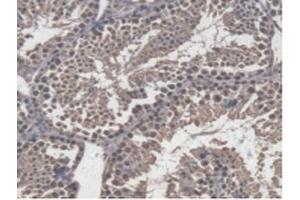 Detection of GBP4 in Mouse Testis Tissue using Polyclonal Antibody to Guanylate Binding Protein 4 (GBP4) (GBP4 抗体  (AA 1-304))
