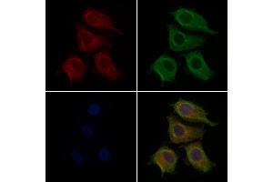 ABIN6257439 and ABIN6276207 staining Hela cells by IF/ICC. (PRLHR 抗体  (Internal Region))
