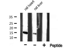 Western blot analysis of extracts of various celllines,using p15 INK Antibody. (CDKN2B 抗体  (Internal Region))