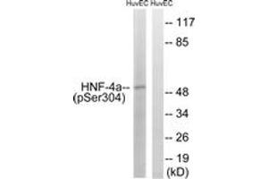 Western blot analysis of extracts from HuvEc cells treated with EGF 200ng/ml 30', using HNF4 alpha (Phospho-Ser313) Antibody. (HNF4A 抗体  (pSer313))