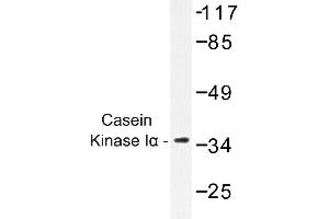 Image no. 1 for anti-Casein Kinase 1, alpha 1 (CSNK1A1) antibody (ABIN272195) (CSNK1A1 抗体)