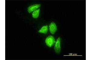 Immunofluorescence of monoclonal antibody to DNAJC3 on HeLa cell. (DNAJC3 抗体  (AA 1-234))