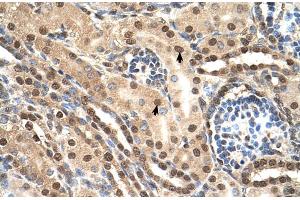 Immunohistochemistry (IHC) image for anti-Transcription Elongation Factor B (SIII), Polypeptide 2 (18kDa, Elongin B) (TCEB2) (Middle Region) antibody (ABIN2777254)