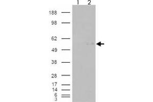 293 overexpressing GCNT3 and probed with GCNT3 polyclonal antibody  (mock transfection in first lane), tested by Origene. (GCNT3 抗体  (AA 273-284))