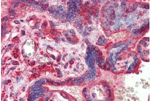 Human Placenta (formalin-fixed, paraffin-embedded) stained with ATF4 antibody ABIN462203 followed by biotinylated goat anti-rabbit IgG secondary antibody ABIN481713, alkaline phosphatase-streptavidin and chromogen. (ATF4 抗体  (N-Term))