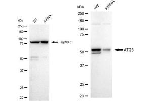 Western blotting analysis using ATG5 antibody (ABIN7797674). (Recombinant ATG5 抗体)
