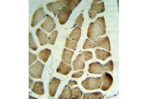 Immunohistochemistry analysis in formalin fixed and paraffin embedded human skeletal muscle tissue reacted with PARVA Antibody (C-term) Cat. (Parvin alpha 抗体  (C-Term))