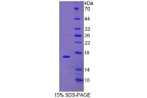 SDS-PAGE of Protein Standard from the Kit  (Highly purified E. (RALBP1 ELISA 试剂盒)