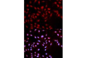 Immunofluorescence analysis of U2OS cell using Phospho-MET-Y1349 antibody.