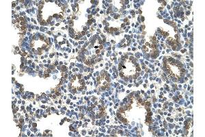 SLC37A3 antibody was used for immunohistochemistry at a concentration of 4-8 ug/ml to stain Alveolar cells (arrows) in Human Lung. (SLC37A3 抗体)