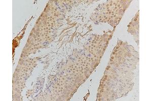 ABIN6255690 and ABIN6267427 at 1/100 staining human testis tissue by IHC-P. (EIF2AK2 抗体  (pThr446))