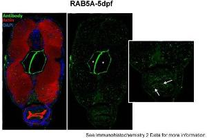 Immunohistochemistry (IHC) image for anti-RAB5A, Member RAS Oncogene Family (RAB5A) (Middle Region) antibody (ABIN2786773)