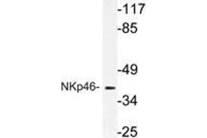 Western blot (WB) analysis of NKp46 antibody in extracts from A549 cells. (NCR1 抗体)