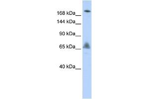 WB Suggested Anti-VPS8 Antibody Titration:  0. (VPS8 抗体  (N-Term))