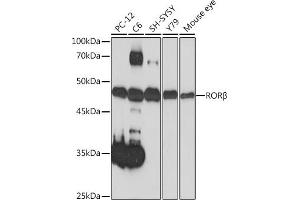 Western blot analysis of extracts of various cell lines, using RORβ Rabbit mAb (ABIN7269855) at 1:1000 dilution. (RORB 抗体)