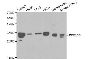 Western blot analysis of extracts of various cell lines, using PPP1CB antibody.