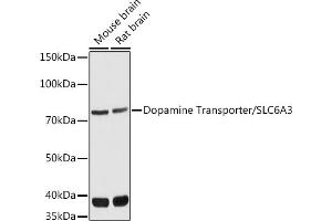 Western blot analysis of extracts of various cell lines, using Dopamine Transporter/SLC6 antibody (ABIN7270474) at 1:1000 dilution. (SLC6A3 抗体  (C-Term))