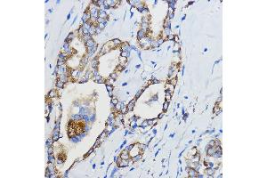 Immunohistochemistry (IHC) image for anti-Cytochrome P450, Family 51, Subfamily A, Polypeptide 1 (CYP51A1) (AA 210-509) antibody (ABIN6139370)