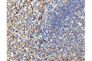 IHC analysis of ICAM1 using anti-ICAM1 antibody (ABIN7601066). (ICAM1 抗体  (AA 28-268))