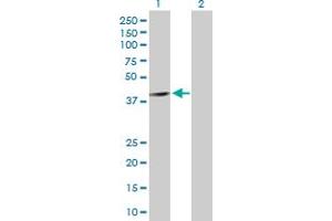 Western Blotting (WB) image for anti-Protein Kinase, AMP-Activated, beta 1 Non-Catalytic Subunit (PRKAB1) (AA 1-270) antibody (ABIN519169)