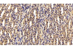 Immunohistochemistry (IHC) image for anti-Adiponectin (ADIPOQ) (AA 111-244) antibody (ABIN7432169)