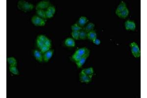 Immunofluorescent analysis of HepG2 cells using ABIN7151747 at dilution of 1:100 and Alexa Fluor 488-congugated AffiniPure Goat Anti-Rabbit IgG(H+L) (EPAS1 抗体  (AA 543-870))