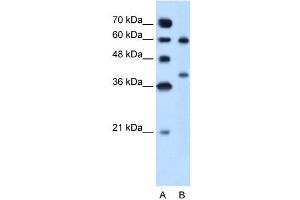 Arginase 1 antibody used at 5 ug/ml to detect target protein.