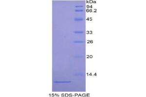 SDS-PAGE (SDS) image for Actin Related Protein 2/3 Complex, Subunit 4, 20kDa (ARPC4) protein (ABIN3008085)