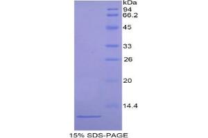 SDS-PAGE analysis of Mouse ARPC4 Protein. (ARPC4 蛋白)