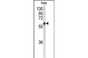 Western blot analysis of GALNT2 Antibody in Hela cell line lysates (35ug/lane) (GALNT2 抗体  (N-Term))
