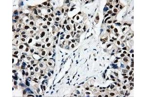Immunohistochemical staining of paraffin-embedded Kidney tissue using anti-CISD1mouse monoclonal antibody. (CISD1 抗体)