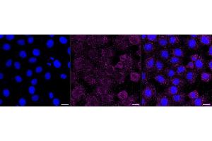 Immunocytochemical staining of HT- cells with Ribophorin I antibody (ABIN7800214), 1:1,000).