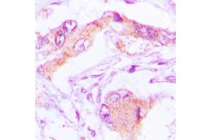 Immunohistochemical analysis of MRPL13 staining in human lung formalin fixed paraffin embedded tissue section.