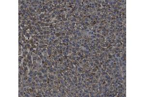 IHC analysis of TGF Beta 1/TGFB1 using anti-TGF Beta 1/TGFB1 antibody (ABIN7603238).