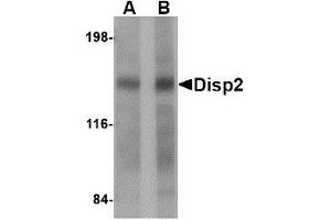 Western blot analysis of Disp2 in rat brain tissue lysate with AP30293PU-N Disp2 antibody at (A) 1 and (B) 2 μg/ml. (DISP2 抗体  (C-Term))