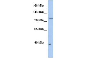 WB Suggested Anti-NEDD4L Antibody Titration:  0. (NEDD4-2 抗体  (Middle Region))