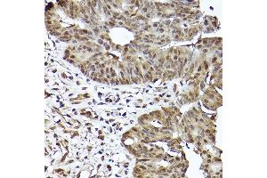 Immunohistochemistry (IHC) image for anti-Signal Transducer and Activator of Transcription 3 (Acute-Phase Response Factor) (STAT3) antibody (ABIN7270305)