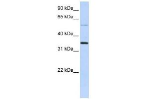 ANKRD9 antibody used at 1 ug/ml to detect target protein. (ANKRD9 抗体  (Middle Region))