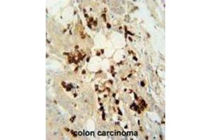 Immunohistochemistry (IHC) image for anti-DDB1 and CUL4 Associated Factor 4-Like 2 (DCAF4L2) antibody (ABIN2995734) (DCAF4L2 抗体)