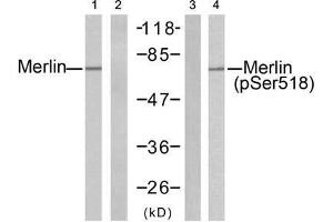 Western blot analysis of extracts from H (Merlin 抗体)