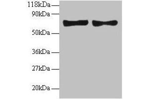 Western blot All lanes: CCL5 antibody at 2 μg/mL Lane 1: EC109 whole cell lysate Lane 2: 293T whole cell lysate Secondary Goat polyclonal to rabbit IgG at 1/15000 dilution Predicted band size: 10 kDa Observed band size: 70 kDa (CCL5 抗体  (AA 24-91))