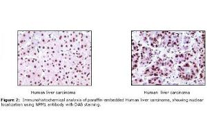 Image no. 1 for anti-Nucleophosmin (Nucleolar phosphoprotein B23, Numatrin) (NPM1) antibody (ABIN207591) (NPM1 抗体)