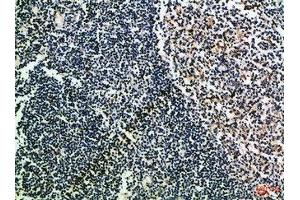 Immunohistochemical analysis of paraffin-embedded Human-tonsil, antibody was diluted at 1:100 (CD52 抗体  (AA 20-50))